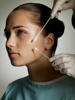 Brunette Woman With Q-Tips On Her Skin For Medical Procedure