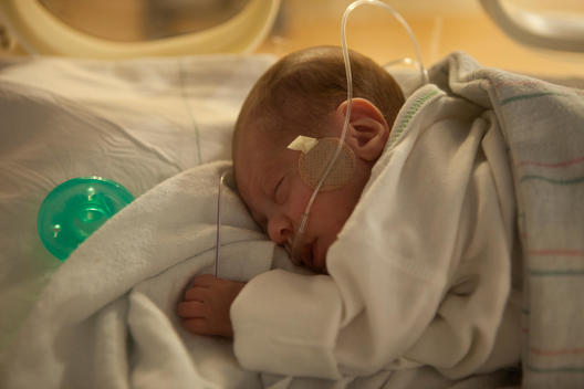 Premature baby in the neonatal intensive care unit