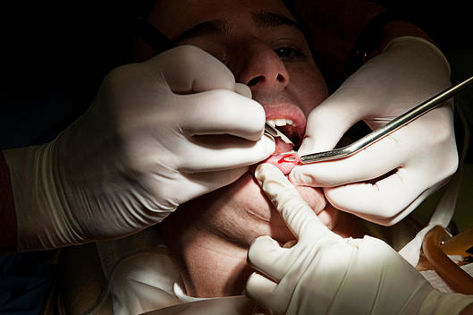 A Dental Surgeon Cutting A Boy'S Lip Open With A Scalpel.