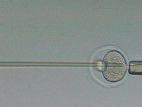 In vitro fertilization of an egg