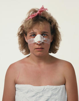 Portrait Of Woman After Nose Job