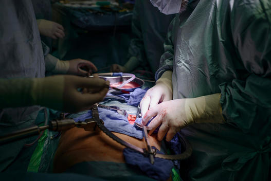 Surgeons transplanting a kidney