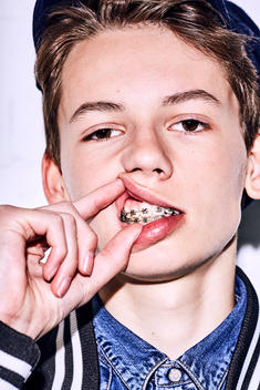 Teenage boy with braces showing his braces, portrait against white