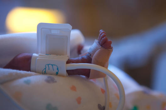 Foot of a premature baby in the neonatal intensive care unit
