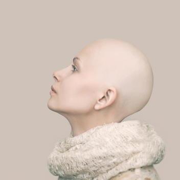 Caucasian woman with bald head
