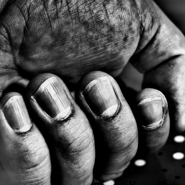 Dirty Hand and Nails