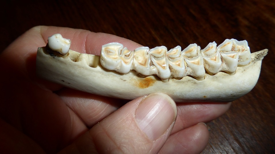 teeth, tooth, dental caries