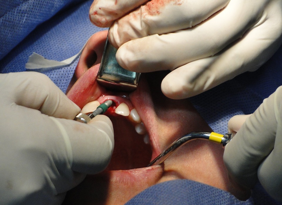 surgery, teeth, operation