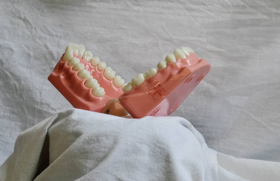 teeth, dental, dental model