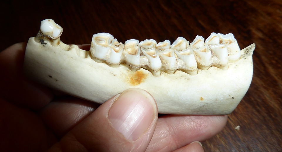 teeth, tooth, dental caries