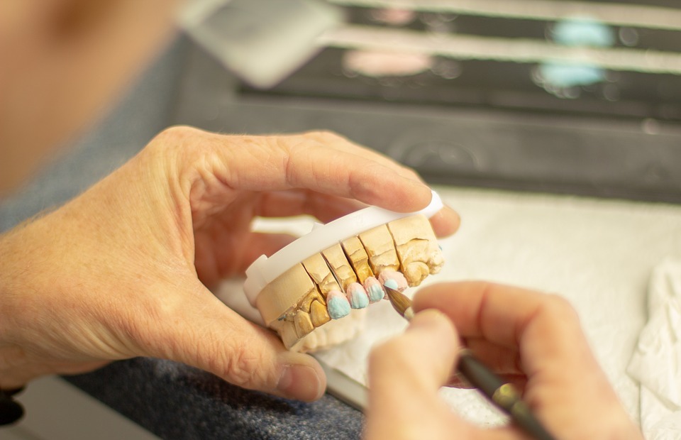 tooth replacement, dentist, healthcare