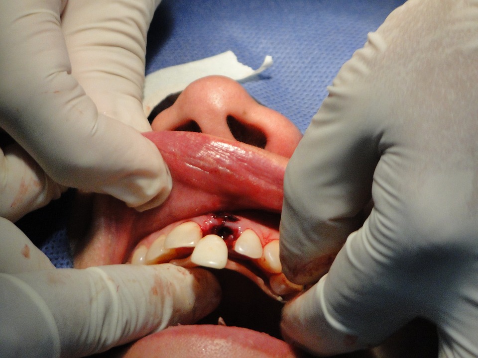 surgery, teeth, operation