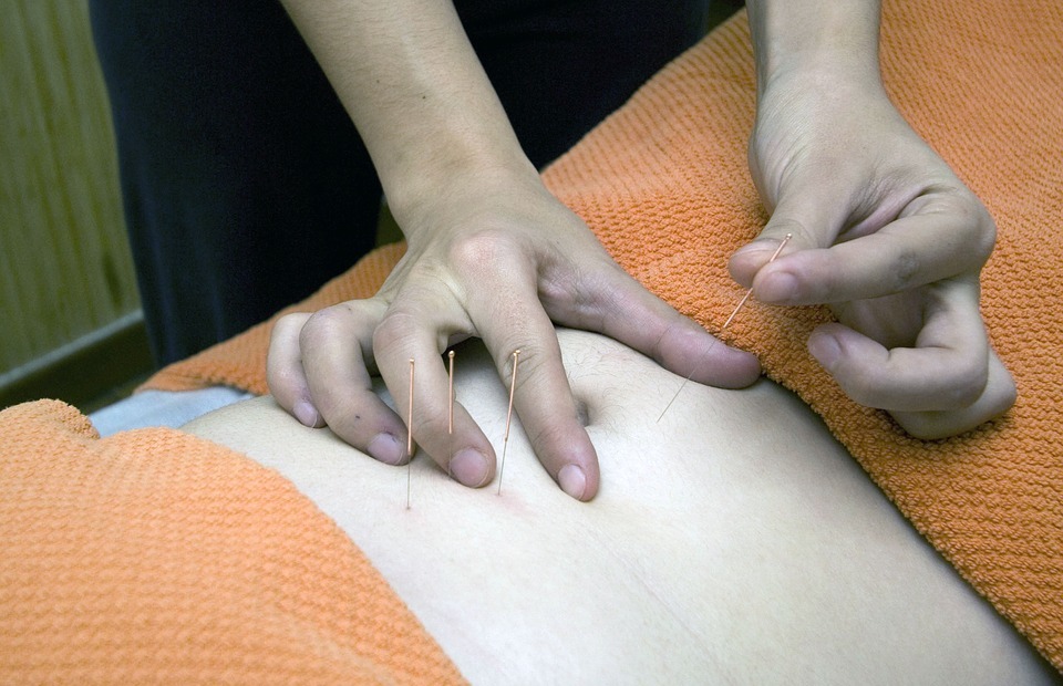acupuncture, physiotherapy, wellness