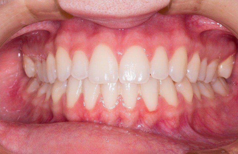 teeth, smile, dentist